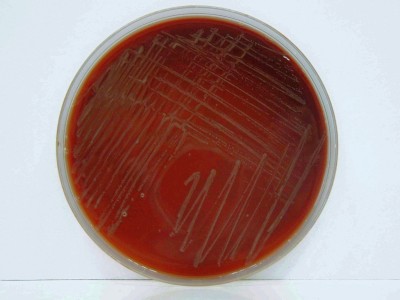 Wzrost Campylobacter jejuni na podłożu Prestona  