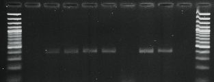 Zdjęcie żelu agarozowego po amplifikacji DNA metodą PCR - wykrywanie genu odpowiedzialnego za czynnik wirulencji Campylobacter spp. 