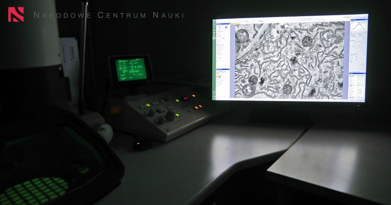 Na biurku w ciemnym pomieszczeniu stoi monitor z wyświetlonym obrazem z mikroskopu. Po prawej stronie stoją sprzęty badawcze